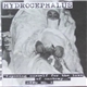 Hydrocephalus - 